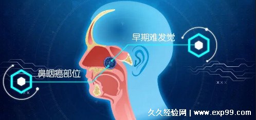 npc是什么意思网络